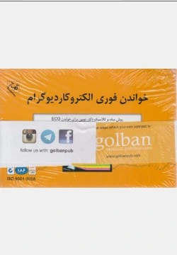 خواندن فوری الکتروکاردیوگرام روش ساده و کلاسیک دکتردوبین برای خواندن( ECG) اثر دوبین